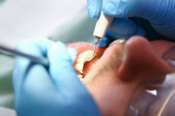 Best Emergency Dental Services for Seniors in Mcallen, TX